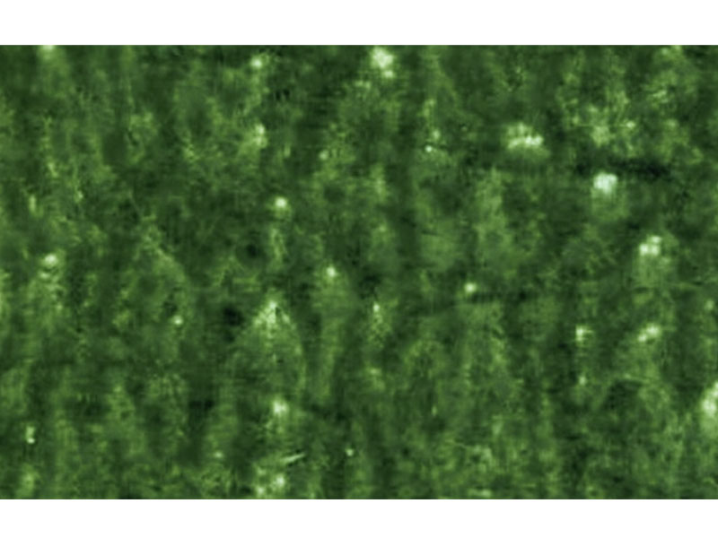 Flexo-Printing-Defects-of-Mottled Image Flexodruckfehler bei fleckigem Bild